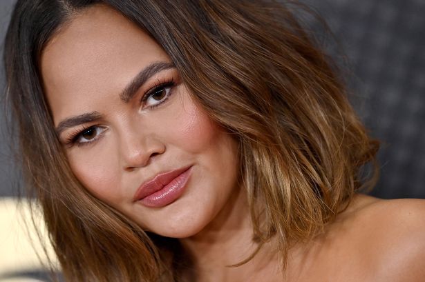 Chrissy Teigen shares ‘crazy’ results of eyebrow transplant – as hair is taken from back of head and stitched to face