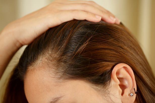 ‘My scalp was itchy for months until I used this £18 Body Shop hair serum once’