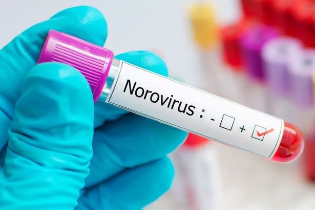 Norovirus symptoms and how to treat contagious infection as it spreads