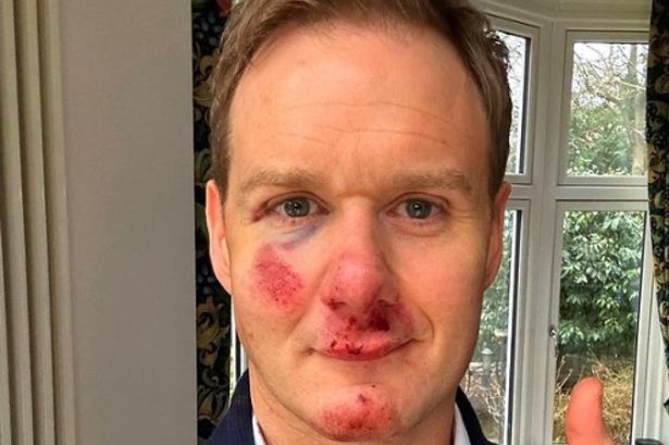 Dan Walker branded a ‘disgrace’ after saying helmet saved his life in bike crash