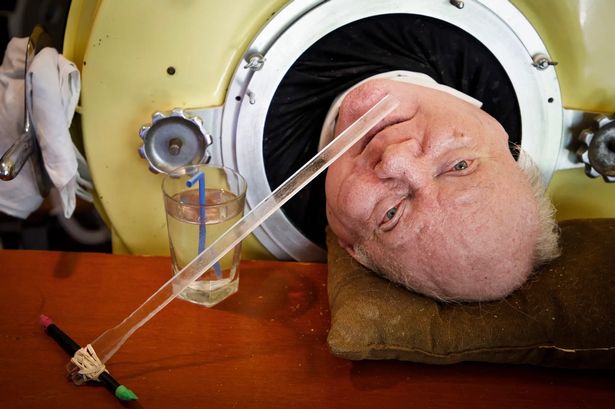 YouTube and TikTok star dies after living for 70 years in 7ft iron lung