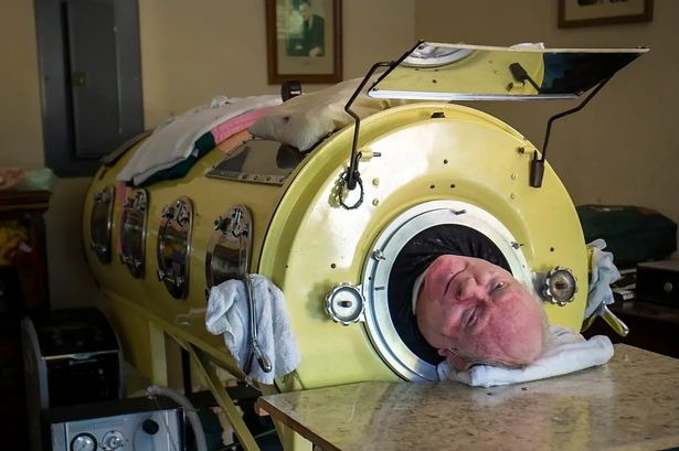 Polio survivor Paul Alexander who spent 70 years in an iron lung dies aged 78