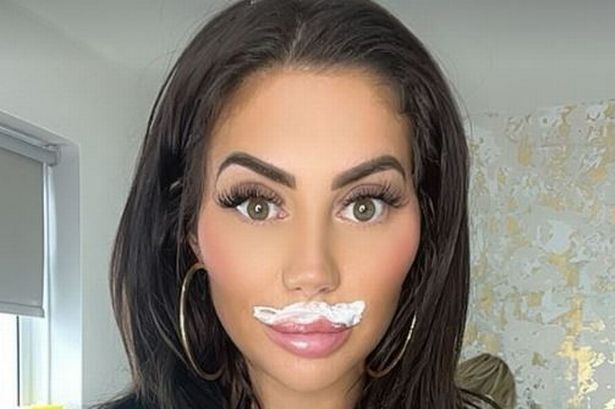 Geordie Shore’s Chloe Ferry has lip filler dissolved – two weeks after breast reduction surgery