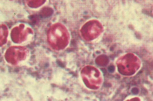 Cryptosporidium health alert issued in seaside town as ‘hundreds’ fall ill