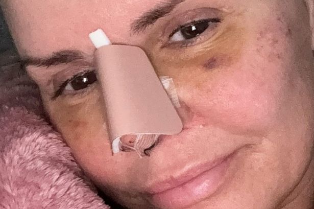 Kerry Katona ‘burst into tears’ over new nose when she saw it for the first time