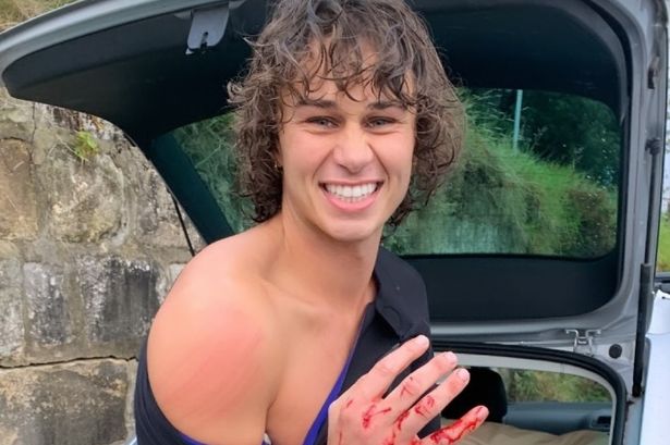 Home and Away star rushed to hospital with horrific hand injury after ‘rock slamming’ accident in sea