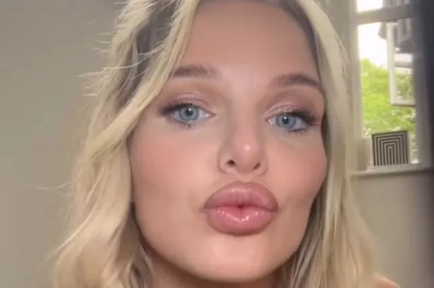 Helen Flanagan opens up about hidden disorder with honest update to fans