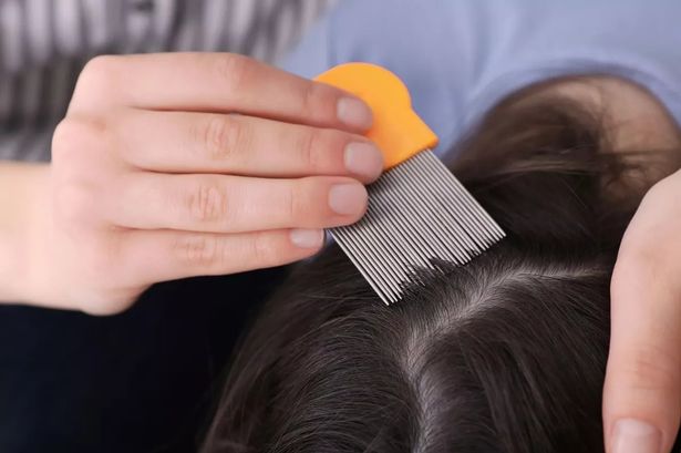 Superdrug issues warning over surge in head lice cases ‘due to warmer weather’