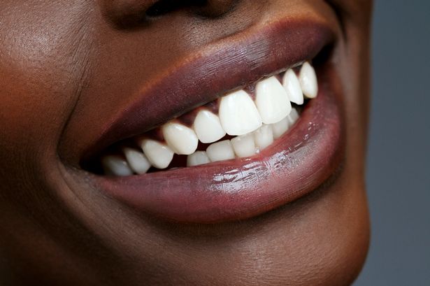 Spotlight launches ‘best ever’ teeth whitening strips for brighter teeth in 14 days