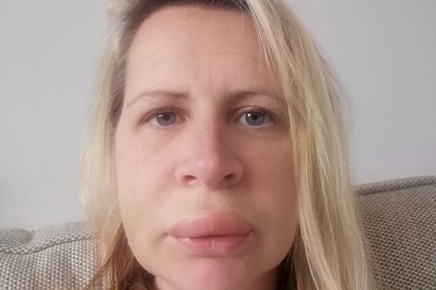 Mum’s face swelled up like a balloon after routine dental appointment turned into nightmare