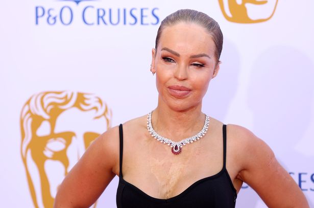 Katie Piper’s acid attacker to face Parole Board in bid for release