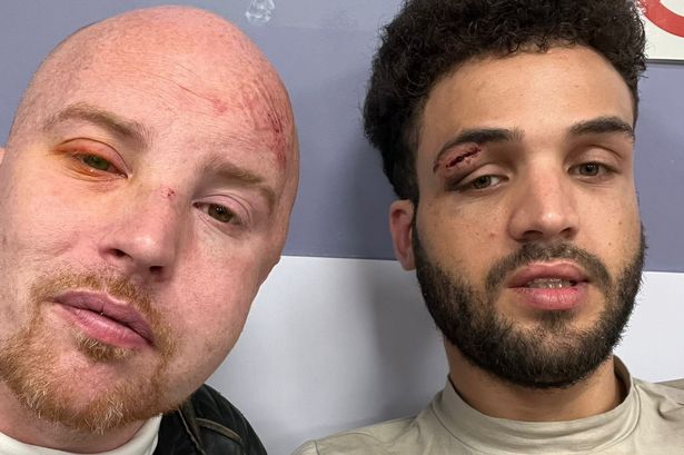 Gay couple left bloodied and bruised in suspected ‘homophobic attack’ outside Blackburn train station