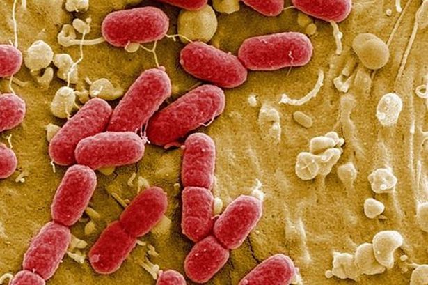 One dead and dozens left ill in E.coli outbreak linked to minced beef