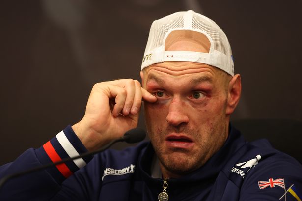 Tyson Fury escorted from Morecambe bar by ‘bravest bouncers’ before collapsing