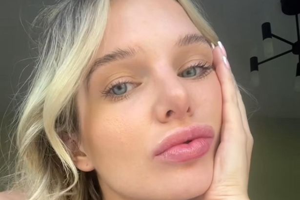 Brave Helen Flanagan opens up on health struggles that left her ‘unable to cope’