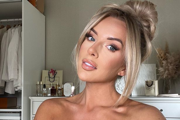 Love Island’s Faye Winter bravely shows ‘real skin’ as she reveals ’embarrassing’ medical condition