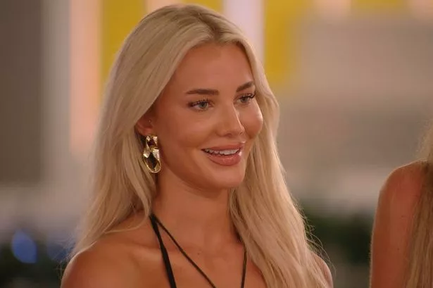 Love Island’s Grace ‘unrecognisable’ in throwback snap as surgery secrets unveiled