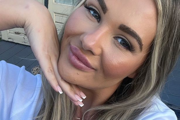 Shaughna Phillips shocks with snaps of new lip filler that caused her to ‘swell’ as she shows face again