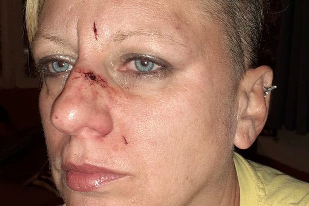 Mum’s trauma after being ‘mauled by two dogs’ at holiday park