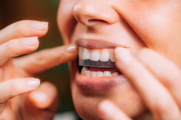 ‘I saw a massive difference and actually like my teeth now’ – whitening strips win praise