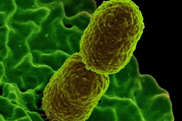 Symptoms of drug-resistant superbug sparking new pandemic concern