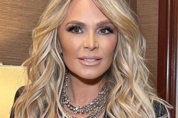 Reality star unrecognisable with ‘oozy’ skin after drastic plastic surgery