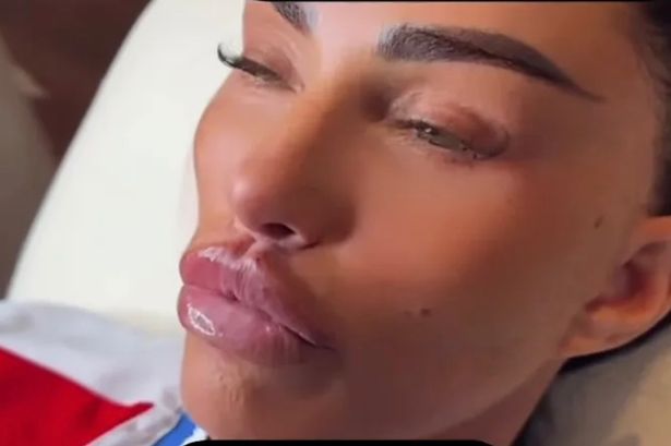 Katie Price pumps controversial ‘butterfly’ lips even bigger – and says she’s getting a ‘plum bum’ next