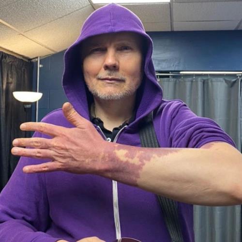 Billy Corgan finally embracing port-wine birthmarks he tried to hide for years