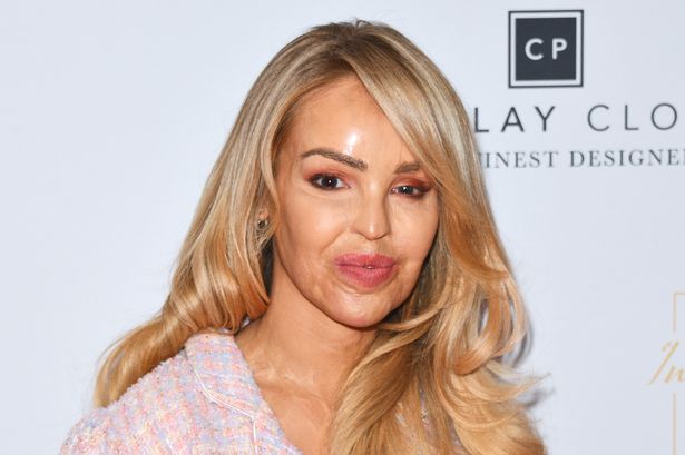 Katie Piper’s heartache over vile trolling as she says ‘this is not ok’