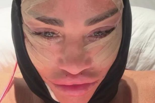 Katie Price left ‘looking like an octopus’ after surgery and was crying out in agony, says ex Carl Woods