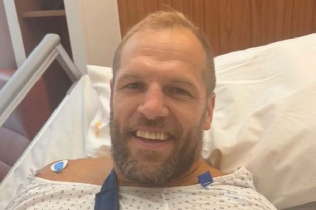 James Haskell shares gruesome extent of injury as arm ‘snapped’ – with him rushed to hospital for surgery