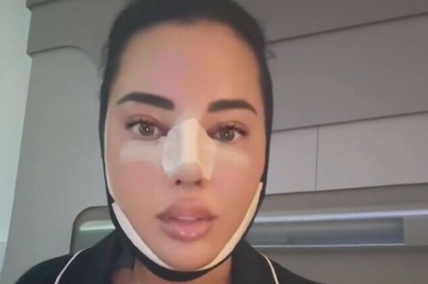 TOWIE’s Yazmin Oukhellou shows off ‘swollen’ and bandaged face after cosmetic surgery in Turkey