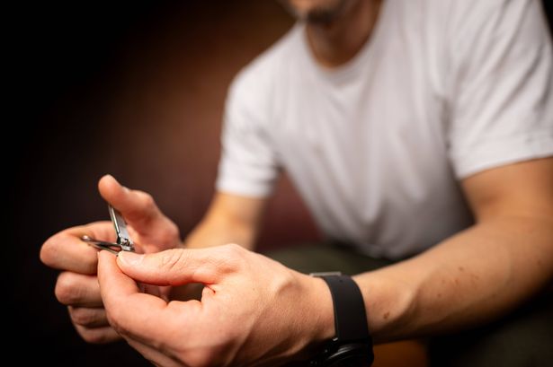 Subtle fingernail changes could be sign of high cholesterol, experts warn