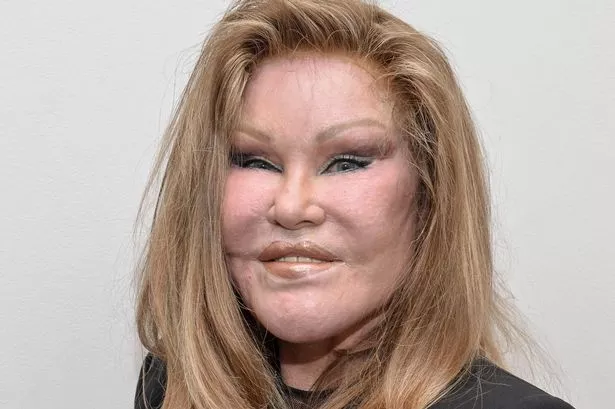 ‘Catwoman’ Jocelyn Wildenstein’s cause of death confirmed after silent struggle