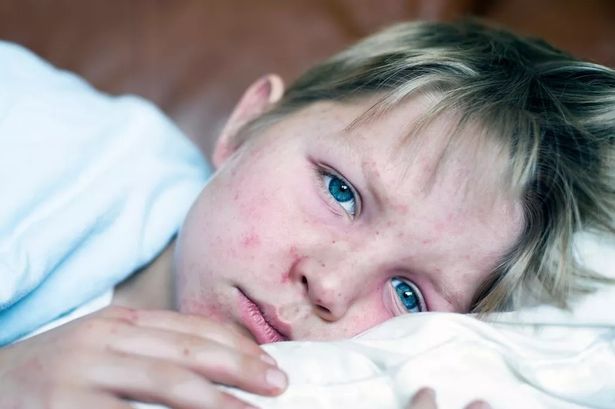 ‘Highly infectious’ disease warning as Government issues urgent advice