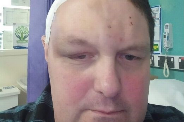 Blackpool man diagnosed with brain tumour at same time as beloved dog