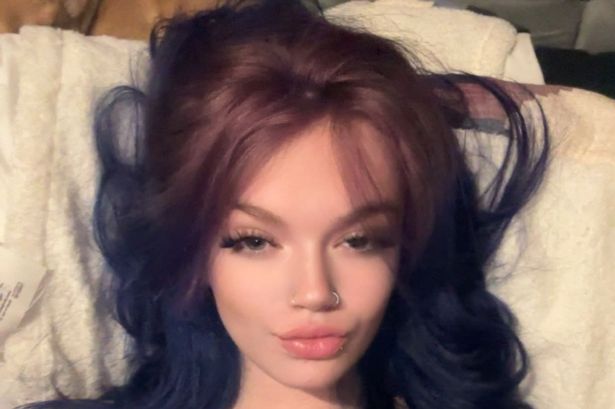 ‘I nearly died after cracked tooth left me looking like Family Guy’s Quagmire’