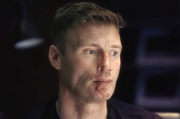 Freddie Flintoff’s response to ‘life-altering’ injuries as he opens up on Top Gear crash