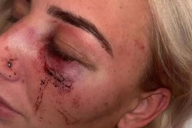 ‘We were on our honeymoon period, then he snapped and I thought I would die’