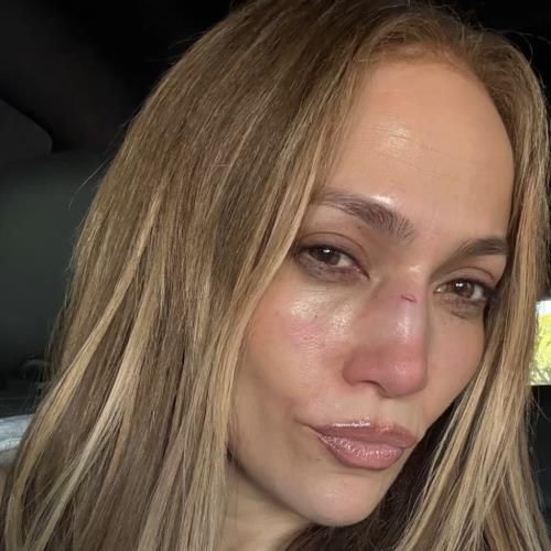 Jennifer Lopez suffers injury during American Music Awards rehearsals