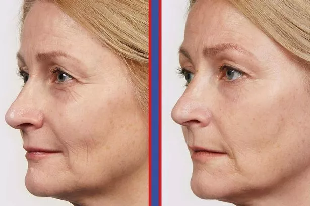 L’Oreal’s best-selling £32 anti-ageing serum that makes ‘lines less visible’ is now £14