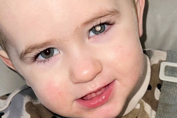 Toddler with unusual white glow in his eye diagnosed with rare disease