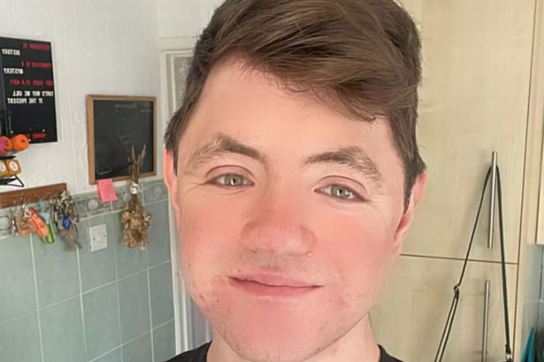 ‘I was spat in Lancashire on my way to a gig – I wasn’t surprised by it’