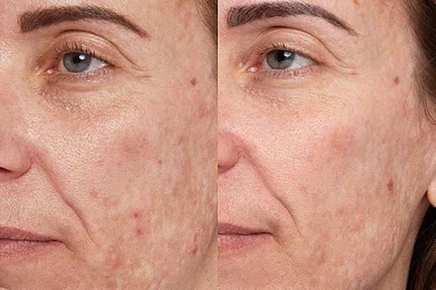 Sell-out pigmentation serum with amazing results – here’s where you can still buy it
