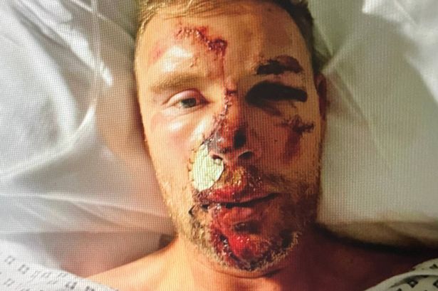 ‘I didn’t know if I had it in me to carry on’: Freddie Flintoff on aftermath of horror crash