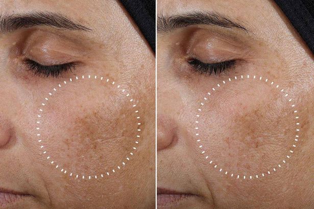‘Magic’ Medik8 serum smooths fine lines and firms up skin ‘within a week’