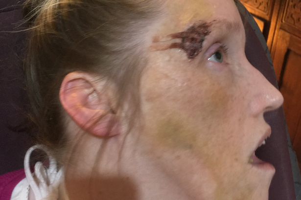 ‘Karen had no voice so we had to be hers’: Family’s fight after disabled woman falls from van under care of charity