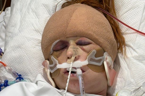 Accrington mum receives terrifying diagnosis after coming down with ‘sick bug’ on holiday