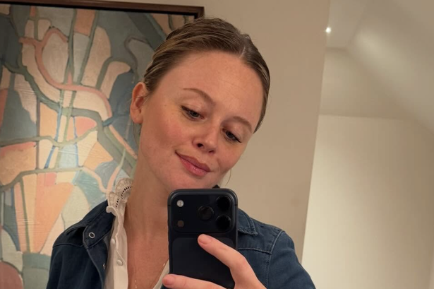 Emily Atack’s favourite winter skincare product for dry, dull skin ‘changed her life’