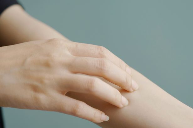 Victorian ‘school’ disease spreading as people mistake it for eczema